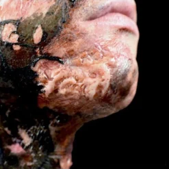 Out Of Kit Burn (Small) Special FX