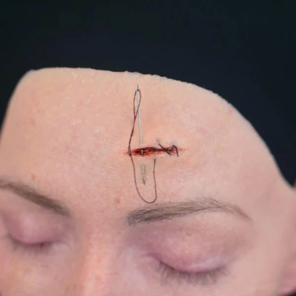 Out Of Kit Stitchable Wound (Small)