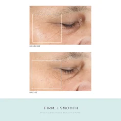 NuFACE Trinity Pro Facial Toning Complete Kit