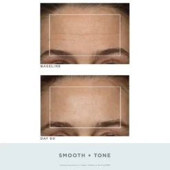 NuFACE Trinity Wrinkle Reducer Red Light Therapy Attachment