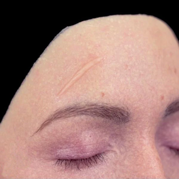 Out Of Kit Single Scar (Small)