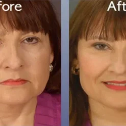 Skincare Art Harding Instant Face And Neck Lift