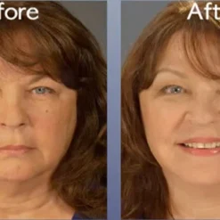 Skincare Art Harding Instant Face And Neck Lift