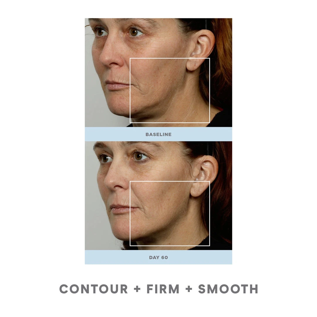 NuFACE Trinity Facial Toning Kit