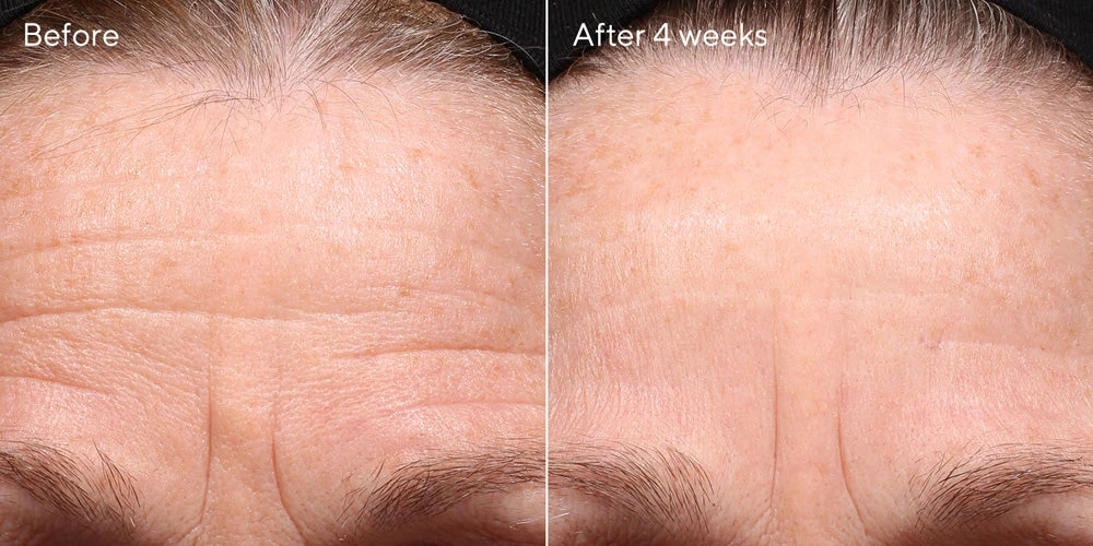 Murad Retinol Youth Renewal Night Cream