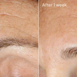 Murad Replenishing Multi-Acid Peel